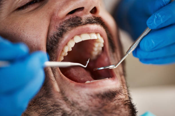 Best Oral Cancer Screening  in Jnstown, OH